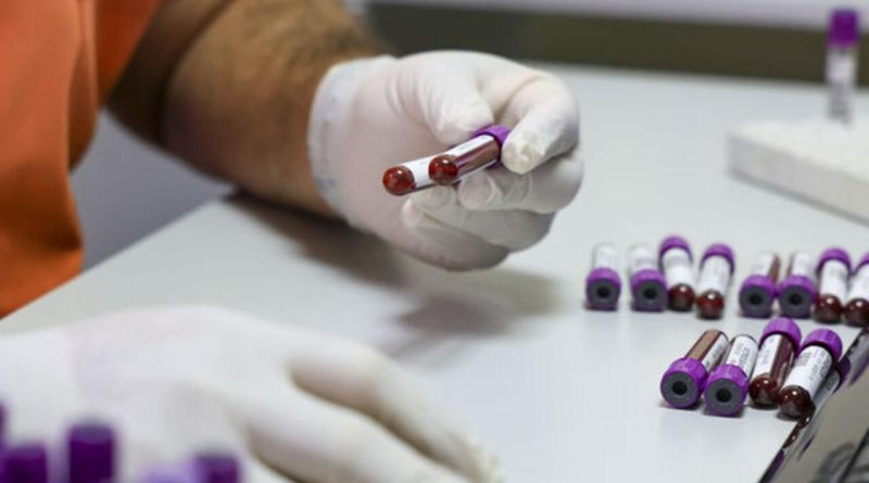 TÜRKİYE'DE İLK KEZ GERÇEKLEŞTİRİYORUZ: İspanya'dan Gelen Altın Kan, Anne ve