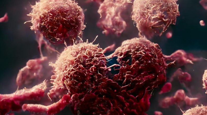 2050'de Kanser Vakaları 30 Milyonu Aşacak Türkiye'nin sağlık sorunlarından biri