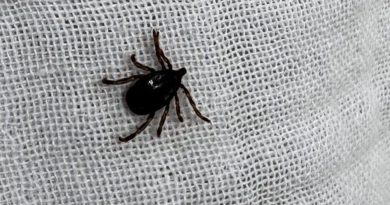 KKKA'da 110 Hastadan 10'u Öldü: Yüzde 90 Oranında Başarı Var