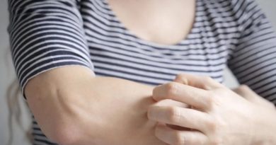 Egzama Türleri: 6 Ana Gruba Ayrılıyor Türkiye'de egzama problemleri oldukça