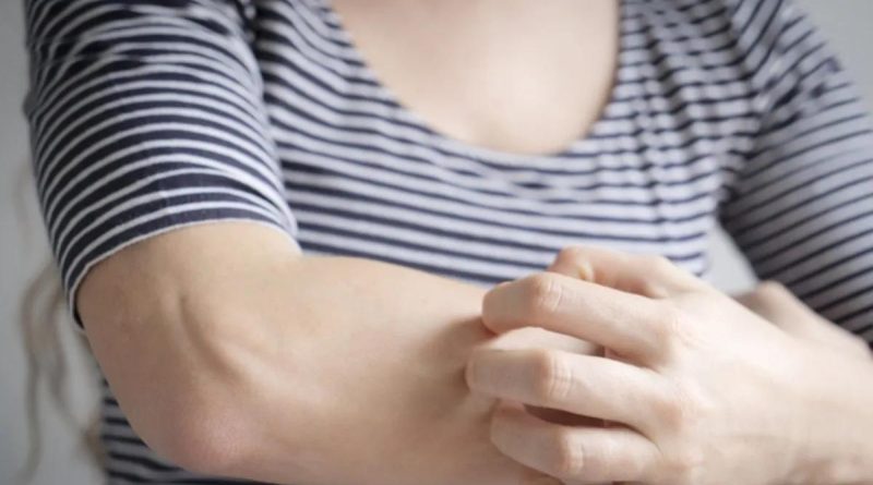 Egzama Türleri: 6 Ana Gruba Ayrılıyor Türkiye'de egzama problemleri oldukça