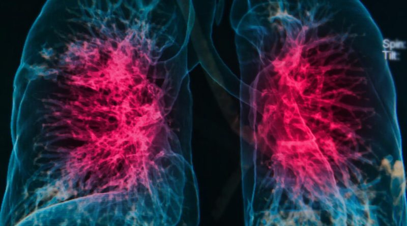 Başlık: Çocukları da yaşlıları da tehdit ediyor! Aşıyla korunmak mümkün