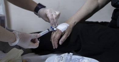 Here is a Turkish text that meets your requirements: SGK,