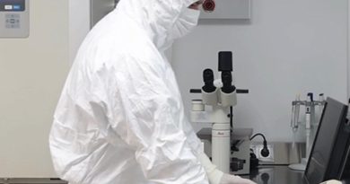 Here is a Turkish text that meets the requirements: Nörolojik