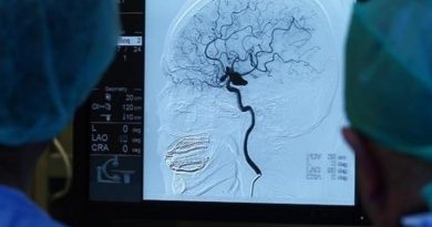 Erken Tedavi ve Rehabilitasyon, İnme Sonrası Kalıcı Hasar Riskini Düşürüyor