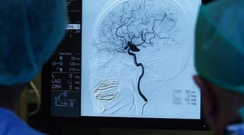 Erken Tedavi ve Rehabilitasyon, İnme Sonrası Kalıcı Hasar Riskini Düşürüyor