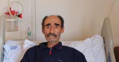 Akciğerinden Alınan Karpuz Büyüklüğündeki Kitle 30 Yıllık Cerrahıyı Şaşırttı Erzurum'da