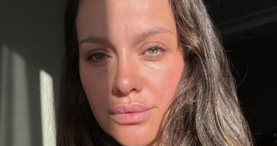 Ünlü Oyuncu İrem Helvacıoğlu'nu Korkutan Kazayı Anlattı Ünlü oyuncu İ