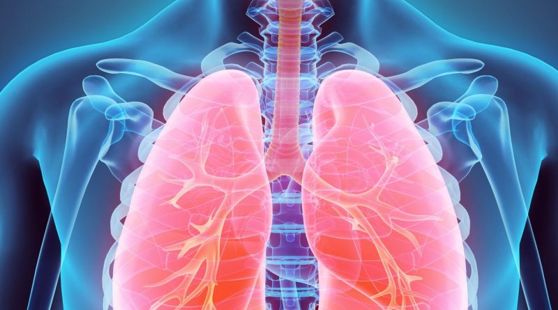Vakalar Artıyor! Akciğer Kanserinden Nasıl Korunulur? Akciğer Kanseri: En Ölümcül
