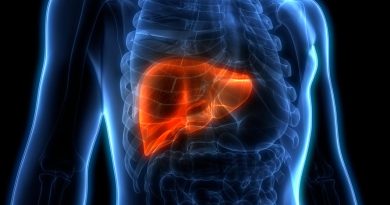 Kalın Bağırsak Kanseri Metastazında Yeni Umut: Karaciğer Nakli Kalın bağırsak