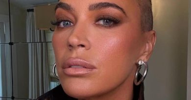 Ünlü Oyuncu Kanseri Yendi: Teddi Mellencamp'ın Mucize Realitesi Teddi Mellencamp,