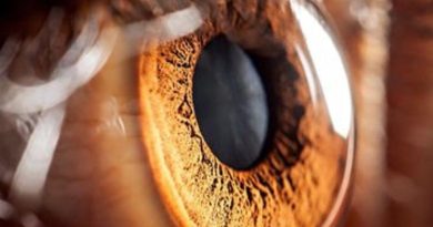 Göz Tansiyonu ve Katarakt, Şeker Hastalarında Normalden 2 Kat Fazla