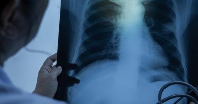 Akciğer Kanseri Riski Artıyor: Çevresel Faktörlerin Etkisi Akciğer Kanseri</strong