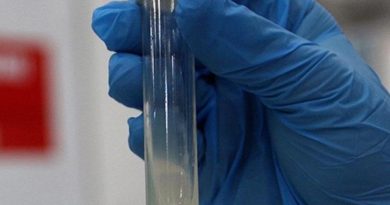 Tüberküloz: Dünyanın En Ölümcül Bulaşıcı Hastalığı Tüberküloz, Her Yıl 1