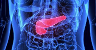 Başlık: Pankreas Kanseri Riskini Artıran Sigara Kullanımı Pankreas kanserinin riski