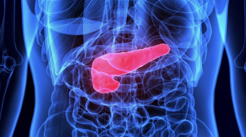 Başlık: Pankreas Kanseri Riskini Artıran Sigara Kullanımı Pankreas kanserinin riski