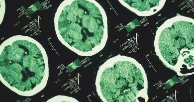 Günde 3 Bin Adım Atmak Alzheimer'ın İlerlemesini Yavaşlatabilir Güne 3