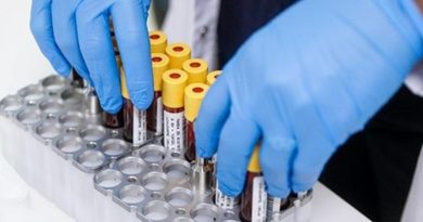 Lösemi artık korkutucu değil Eskişehir Osmangazi Üniversitesi Tıp Fakültesi Çocuk