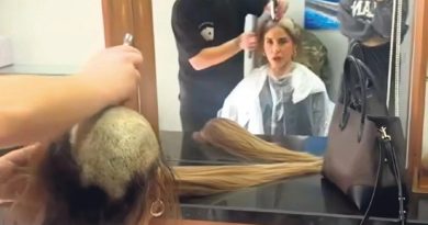 Here is a new content in Turkish: Başlık: Saçlar Gitti