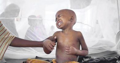 Here is the rewritten text in Turkish: Başlık: Kolera Salgını