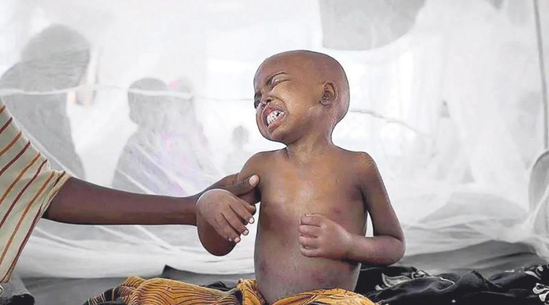 Here is the rewritten text in Turkish: Başlık: Kolera Salgını