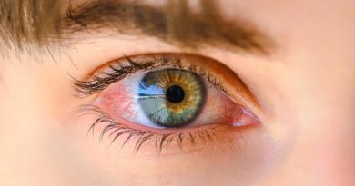 Göz Tansiyonunda Erken Teşhis Kalıcı Körlüğü Engelliyor Türkiye'de göz tansiyonu