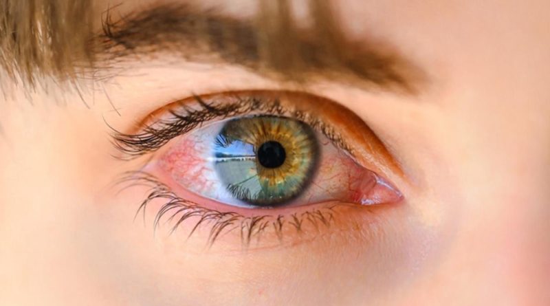 Göz Tansiyonunda Erken Teşhis Kalıcı Körlüğü Engelliyor Türkiye'de göz tansiyonu