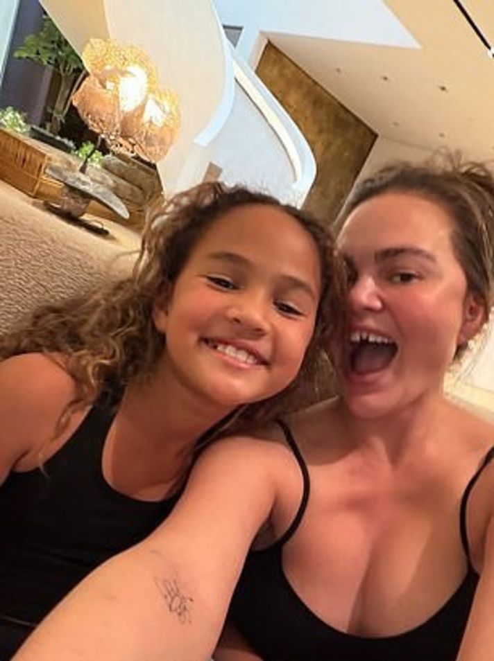 Chrissy'nin kırık dişiyle şeker oyunu oynadı, tedaviyi eğlenceli gösterdi