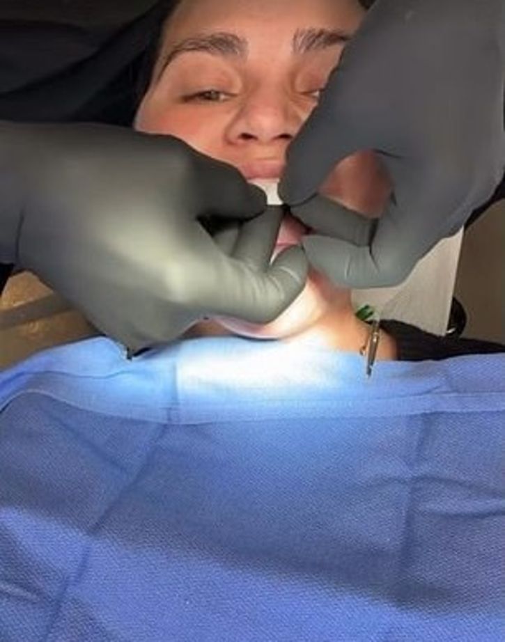 Chrissy'nin kırık dişiyle şeker oyunu oynadı, tedaviyi eğlenceli gösterdi