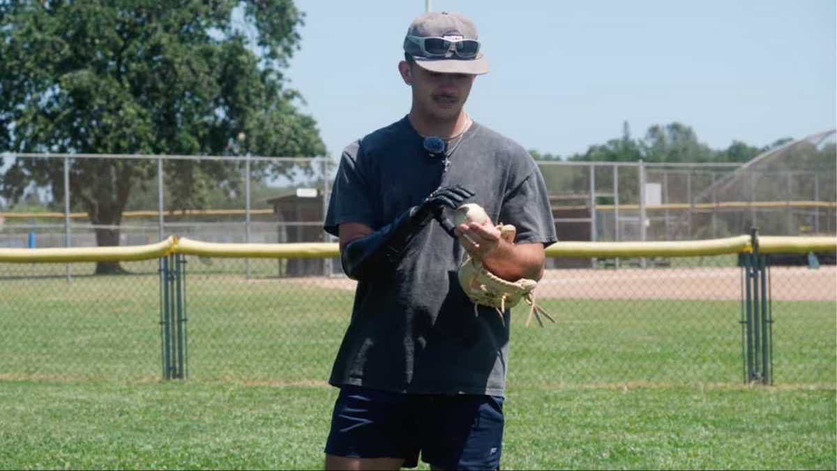 Bionik el, bireyin hayallerini yeniden canatar teknolojiden umutlu bir bakış