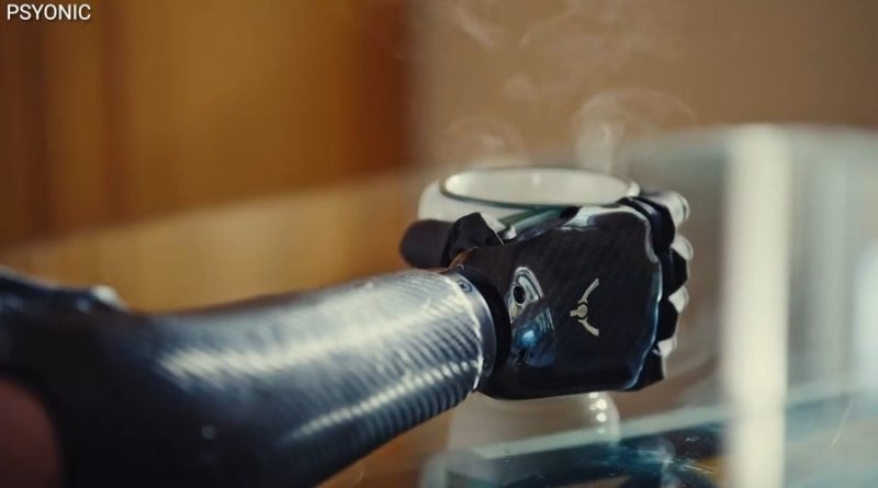 Bionik el, hayalinin gerçekleştiği anıt gününez