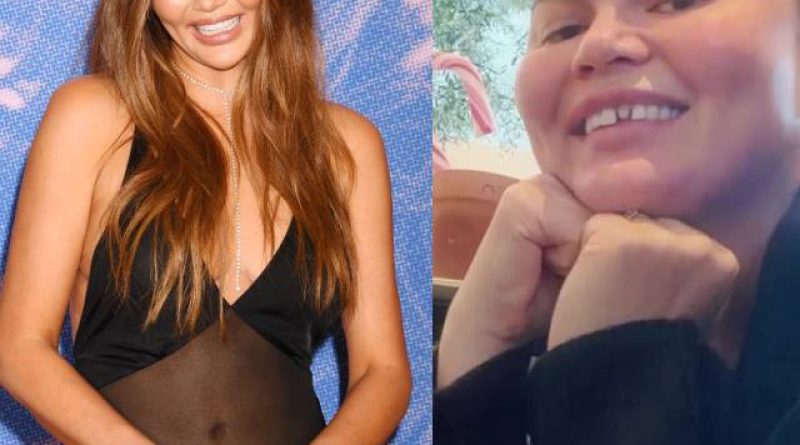 Chrissy'nin kırık dişiyle şeker oyunu oynayan ailesi