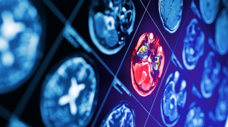 Hızlı ve doğru müdahale, hayat kurtarır, farkında olun