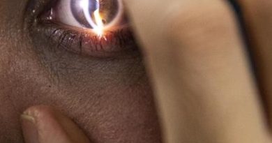 Göz sağlığında yapay zeka, dikkatli kullanım şart