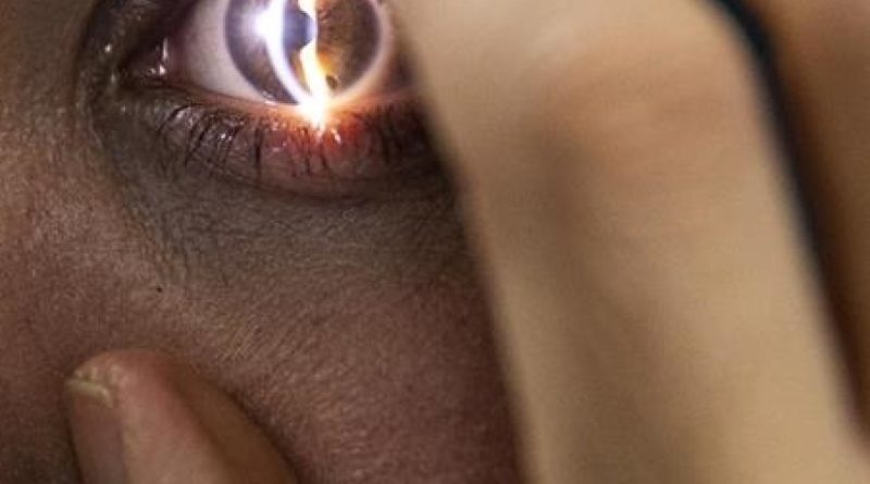 Göz sağlığında yapay zeka, dikkatli kullanım şart