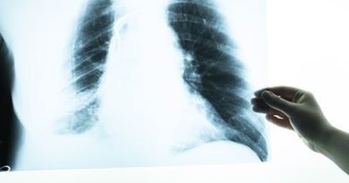 Öksürük, kilo kaybı ihmal etmeyin, tüberkülozu tanıyın