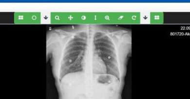Verem tanısı artık daha hızlı ve kolay