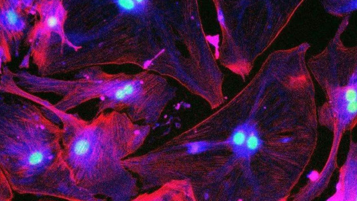 Senesans hücreler: Yaşlanma, fayda, zarar dengesi