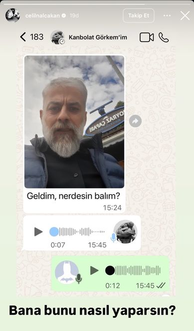 Sanatçı kayıpları yürek yakıyor, anısı yaşayacak