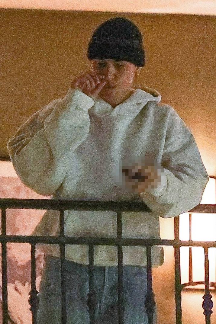 Burnu karıştırmak, pop yıldızı, balkon, Beverly Hills