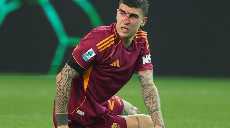 Mancini'nin burun ameliyatı, sahada yaşanan talihsiz anı