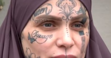 Yara izleri, sanata dönüşen hayat hikayesi