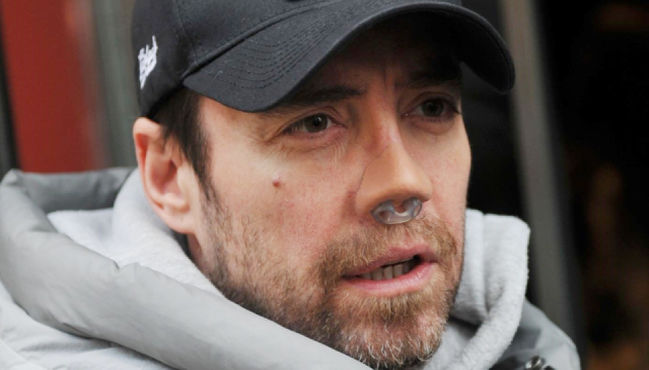 Yine mi? Ünlü ses, estetik maratonuna devam ediyor