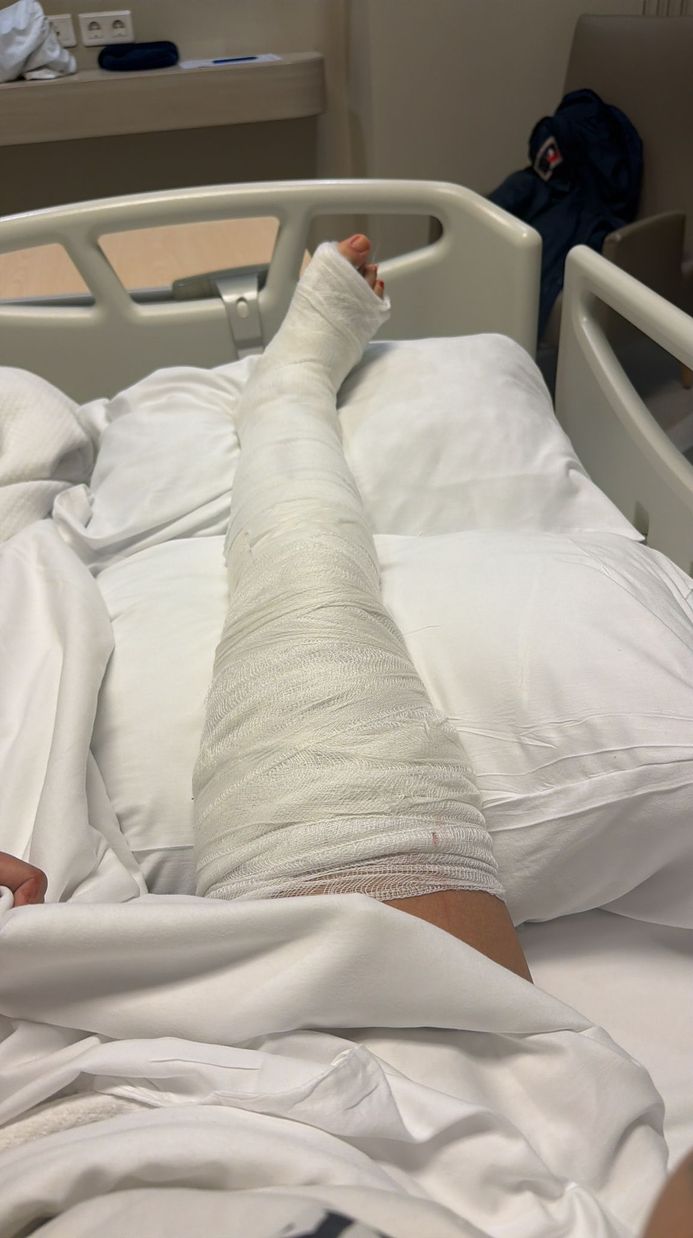 Düşüş, kaza, eski şarkıcı, kırık ayak, acı haber