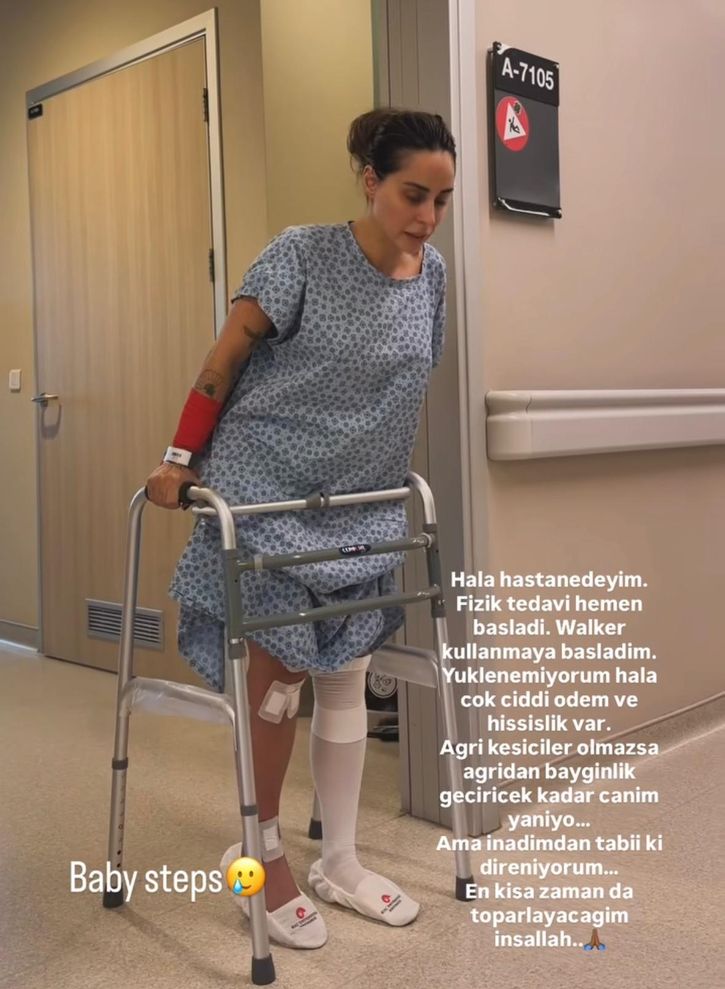 Ayağı kırıldı, yürüyüş keyfi yerini alçıya bıraktı