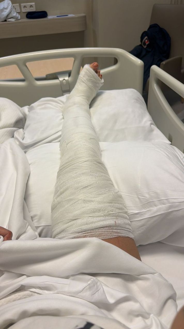 Ayağı kırıldı, yürüyüş keyfi yarım kaldı