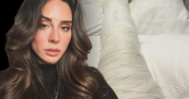 İstanbul'da düşüş, eski şarkıcıyı ayağını kırdı