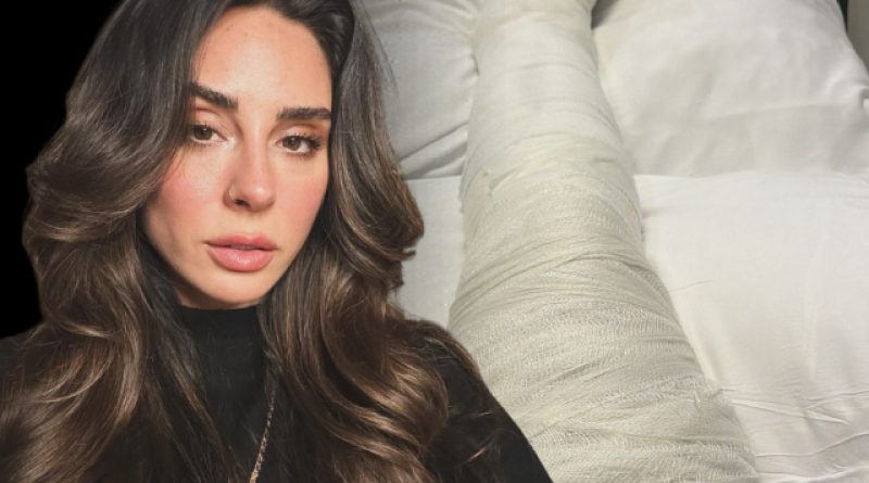 İstanbul'da düşüş, eski şarkıcıyı ayağını kırdı