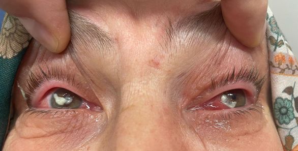 Gözler karanlığa daldı, umutla müdahale etti, yeniden gördü